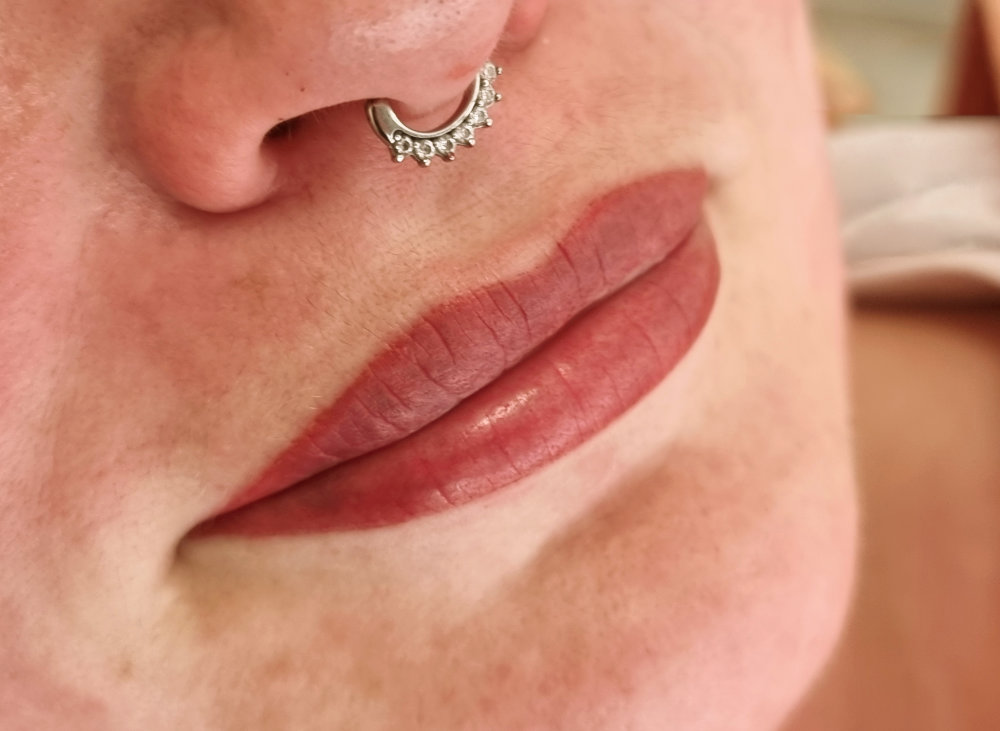 lippen 3 nachher