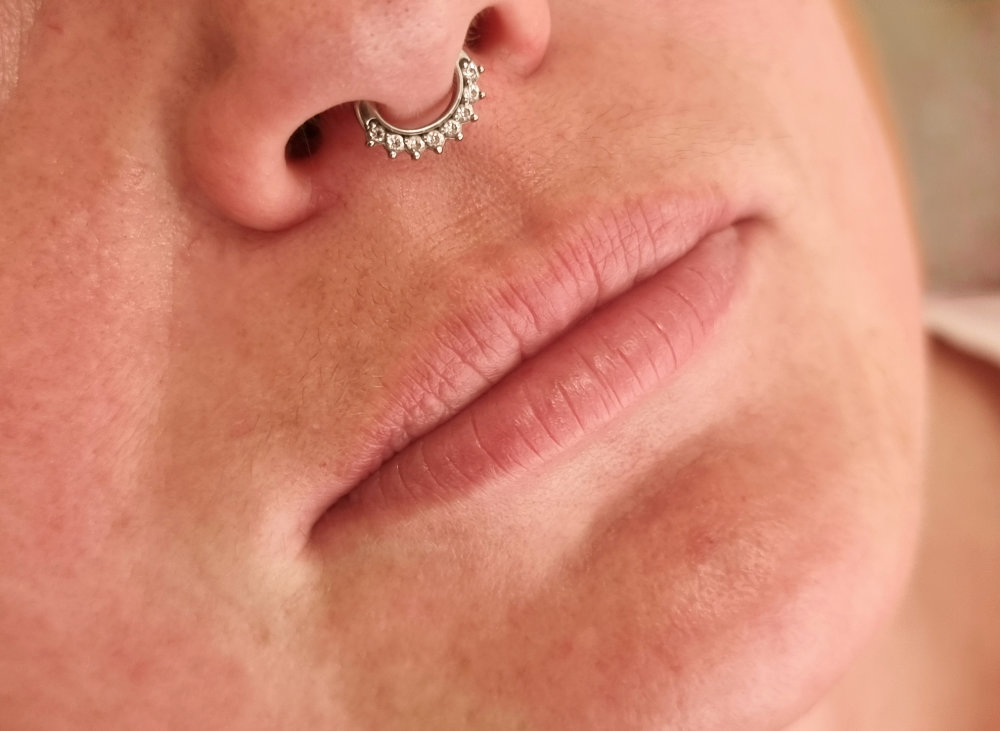 lippen 3 vorher