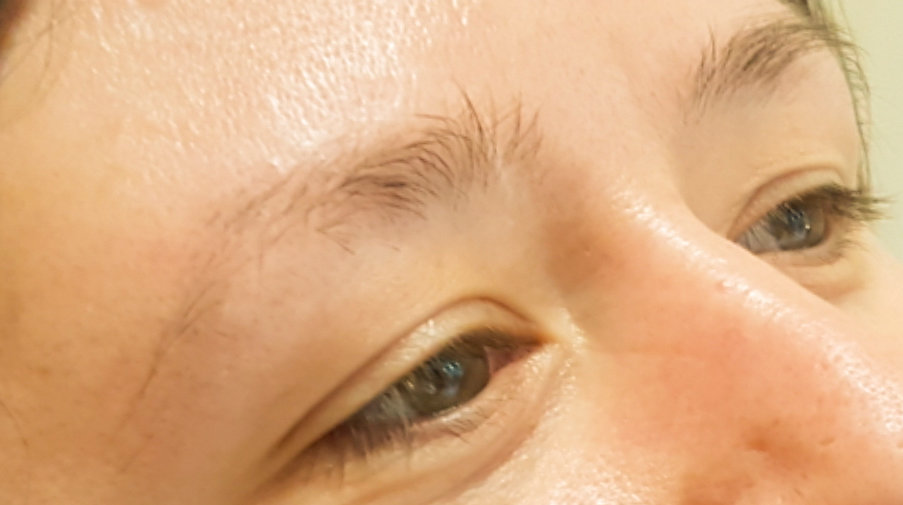 microblading1-vorher