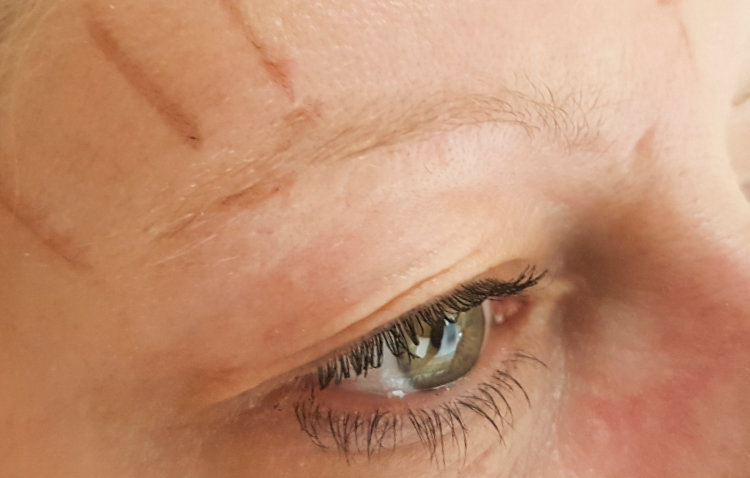 microblading7-vorher
