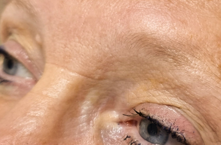 microblading8-vorher